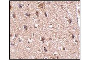 Immunohistochemistry of JPH3 in human brain tissue with this product at 2.