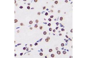 Immunohistochemical analysis of WDR5 staining in human kidney formalin fixed paraffin embedded tissue section.