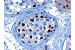 ABIN185160 (3µg/ml) staining of paraffin embedded Human Testis. (KPNA4 anticorps  (C-Term))