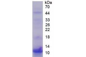 SDS-PAGE of Protein Standard from the Kit (Highly purified E.