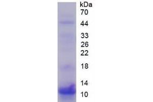 SDS-PAGE of Protein Standard from the Kit (Highly purified E. (S100P Kit ELISA)