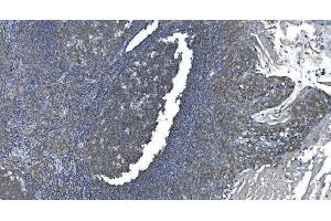 IHC analysis of eRF1/ETF1 using anti-eRF1/ETF1 antibody (ABIN7602625). (ETF1 anticorps  (AA 9-342))