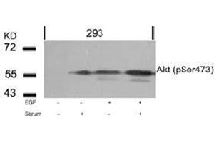 Image no. 2 for anti-V-Akt Murine Thymoma Viral Oncogene Homolog 1 (AKT1) (pSer473) antibody (ABIN196708) (AKT1 anticorps  (pSer473))