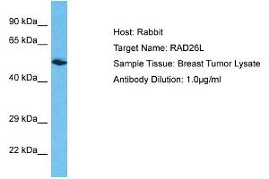 Host: Rabbit Target Name: RAD26L Sample Type: Breast Tumor lysates Antibody Dilution: 1. (ERCC6L2 anticorps  (N-Term))