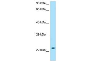 WB Suggested Anti-SLC50A1 AntibodyTitration: 1. (SLC50A1 anticorps  (C-Term))