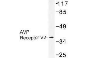 Image no. 1 for anti-Arginine Vasopressin Receptor 2 (AVPR2) antibody (ABIN317870) (AVPR2 anticorps)