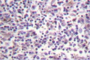 Image no. 1 for anti-B-Raf proto-oncogene, serine/threonine kinase (BRAF) antibody (ABIN271999) (BRAF anticorps)