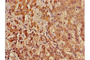 Immunohistochemistry of paraffin-embedded human liver tissue using ABIN7158499 at dilution of 1:100 (ACADL anticorps  (AA 30-260))