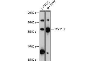 Western blot analysis of extracts of various cell lines, using TCP11L2 antibody (ABIN6133204, ABIN6148958, ABIN6148959 and ABIN6217166) at 1:3000 dilution. (TCP11L2 anticorps  (AA 1-340))