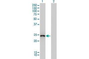 Lane 1: GSTA1 transfected lysate ( 26 KDa). (GSTA1 HEK293 Cell Transient Overexpression Lysate(Non-Denatured))