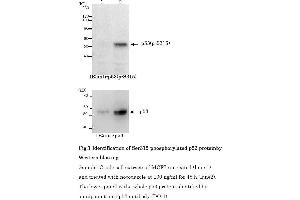 Western Blotting (WB) image for anti-Tumor Protein P53 (TP53) (pSer315) antibody (ABIN3201006) (p53 anticorps  (pSer315))