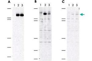 Immunoblot of MAP3K5 (phospho S83) polyclonal antibody  shows specificity for phosphorylated human MAP3K5.