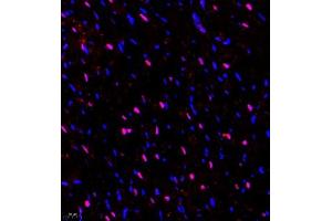 Immunofluorescence of paraffin embedded rat heart using ZNF106 (ABIN7076260) at dilution of 1:500 (400x lens)