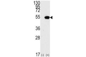 Western blot analysis of p53 antibody and 293 cell lysate (2 ug/lane) either nontransfected (Lane 1) or transiently transfected with the TP53 gene (2).