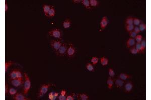 ABIN6277430 staining Hela cells by IF/ICC.