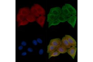 ABIN6257699 and ABIN6274595 staining Hela cells(30 min of UV treatment) by IF/ICC. (OB Cadherin anticorps  (Internal Region))