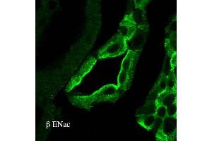 Immunohistochemistry analysis using Rabbit Anti-ENaC Polyclonal Antibody . (SCNN1A anticorps  (AA 617-638) (HRP))
