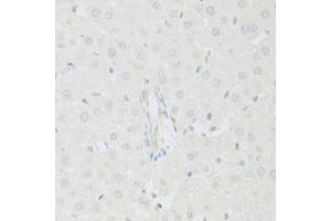 Immunohistochemistry of paraffin-embedded rat liver using KAT2A antibody (ABIN5971244) at dilution of 1/100 (40x lens). (KAT2A anticorps)