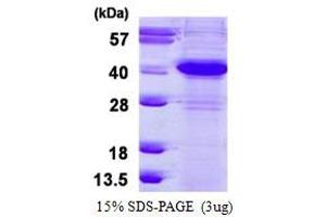 Image no. 1 for Excision Repair Cross Complementing Polypeptide-1 (ERCC1) (AA 1-273) protein (His tag) (ABIN1098618)