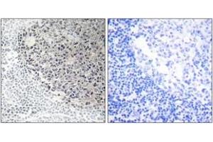 Immunohistochemistry analysis of paraffin-embedded human tonsil tissue, using Collagen IX alpha3 Antibody.