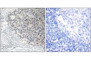 Immunohistochemistry analysis of paraffin-embedded human tonsil tissue, using Collagen IX alpha3 Antibody. (COL9A3 anticorps  (AA 321-370))