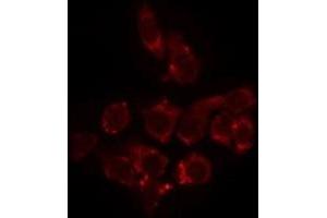 ABIN6275241 staining HeLa by IF/ICC. (SLC25A11 anticorps  (Internal Region))