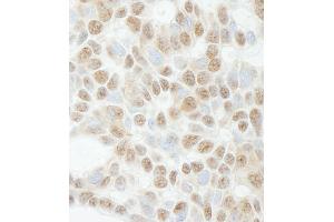 anti-Activity-Dependent Neuroprotector Homeobox (ADNP) (C-Term) antibody