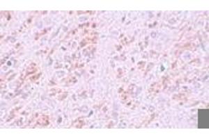 Immunohistochemistry (IHC) image for anti-VENT Homeobox (VENTX) (Middle Region) antibody (ABIN1031159) (VENTX anticorps  (Middle Region))