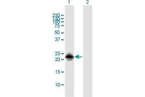 Western Blot analysis of MSRB3 expression in transfected 293T cell line by MSRB3 MaxPab polyclonal antibody. (MSRB3 anticorps  (AA 1-185))
