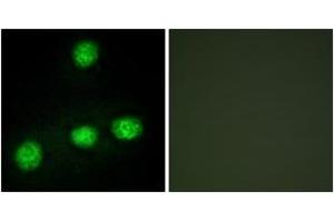 Immunofluorescence analysis of HuvEc cells, using CLK1 Antibody.