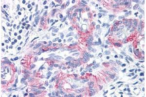 Vessels in Human Uterus: Formalin-Fixed, Paraffin-Embedded (FFPE) (MCAM anticorps)