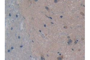 Detection of GR in Rat Spinal cord Tissue using Polyclonal Antibody to Glutathione Reductase (GR)