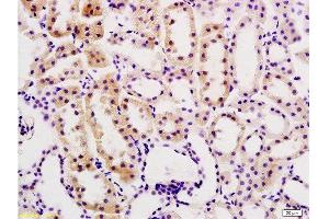 Formalin-fixed and paraffin embedded rat kidney tissue labeled with Anti-Desmin Polyclonal Antibody, Unconjugated  at 1:200, followed by conjugation to the secondary antibody and DAB staining