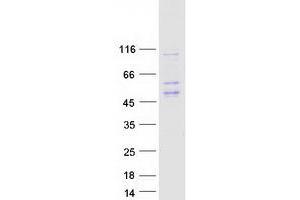 Validation with Western Blot (HLA-E Protein (Myc-DYKDDDDK Tag))