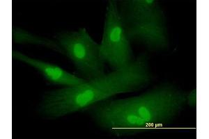 Immunofluorescence of purified MaxPab antibody to SPA17 on Hs 181.