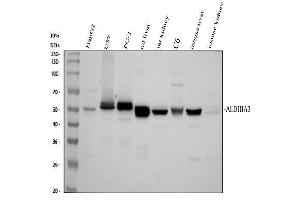 Western blot analysis of ALDH1A3 using anti-ALDH1A3 antibody (ABIN5518802).