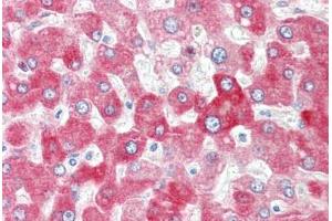 Image no. 2 for anti-UDP Glucuronosyltransferase 1 Family, Polypeptide A4 (UGT1A4) (AA 59-108) antibody (ABIN6749736)