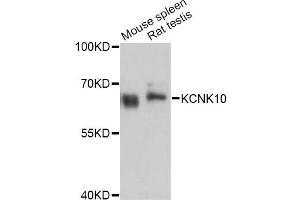 Western blot analysis of extracts of various cell lines, using KCNK10 Antibody (ABIN4904134) at 1:3000 dilution. (KCNK10 anticorps)