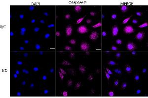 Immunocytochemical staining of HeLa cells using Caspase 9 antibody (ABIN7797910), 1:1,000), Top panel: wild-type (WT), Bottom panal: Caspase 9 shRNA knockdown (KD).