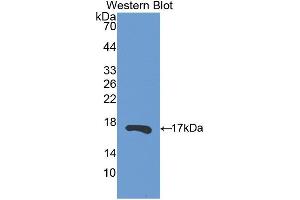 Western blot analysis of the recombinant protein. (RNASE13 anticorps  (AA 20-156))
