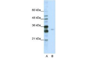 WB Suggested Anti-SFRS1  Antibody Titration: 0. (SRSF1 anticorps  (C-Term))