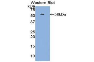 Western blot analysis of the recombinant protein. (Netrin 1 anticorps  (AA 313-565))