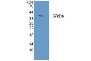 Detection of Recombinant RDX, Human using Polyclonal Antibody to Radixin (RDX) (Radixin anticorps  (AA 5-295))