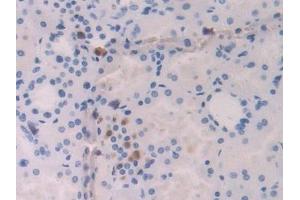 Detection of IL18 in Human Kidney Tissue using Polyclonal Antibody to Interleukin 18 (IL18)