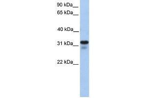 HS3ST6 antibody used at 1 ug/ml to detect target protein. (Heparan Sulfate (Glucosamine) 3-O-Sulfotransferase 6 (HS3ST6) anticorps)