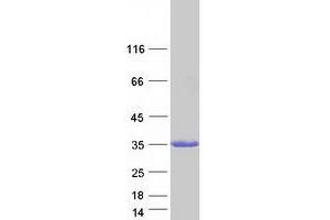 Validation with Western Blot