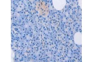 IHC-P analysis of Human Tissue, with DAB staining. (PDGFC anticorps  (AA 235-345))