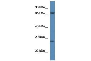 Western Blot showing F11 antibody used at a concentration of 1 ug/ml against Hela Cell Lysate (Factor XI anticorps  (C-Term))