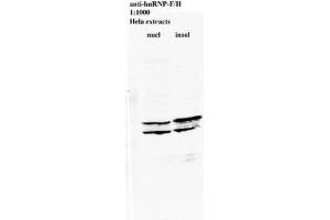 Image no. 2 for anti-Heterogeneous Nuclear Ribonucleoprotein L (HNRNPL) antibody (ABIN108560) (HNRNPL anticorps)