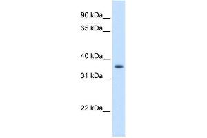 WB Suggested Anti-AKR1B10 Antibody Titration:  1. (AKR1B10 anticorps  (N-Term))